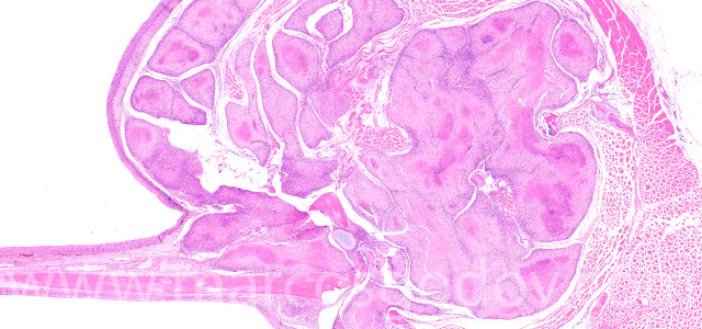 Dermatisis articular IX