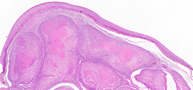 Dermatisis articular VII