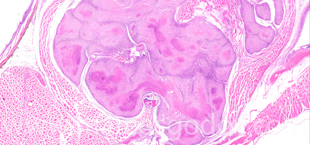 Dermatisis articular XI