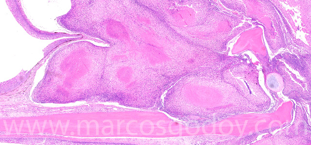 Dermatisis articular XII