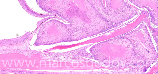 Dermatisis articular XIII