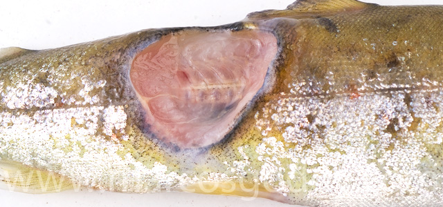 Cutaneous lesion XV