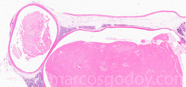 Protenacius plug X