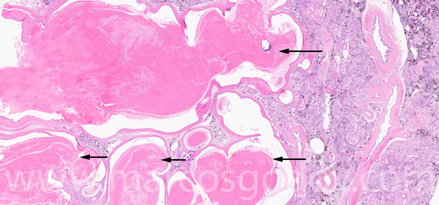Protenacius pug I