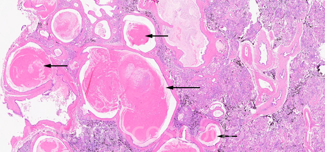 Protenacius pug II