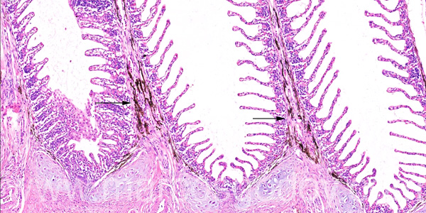 Gill melanomacrophages I