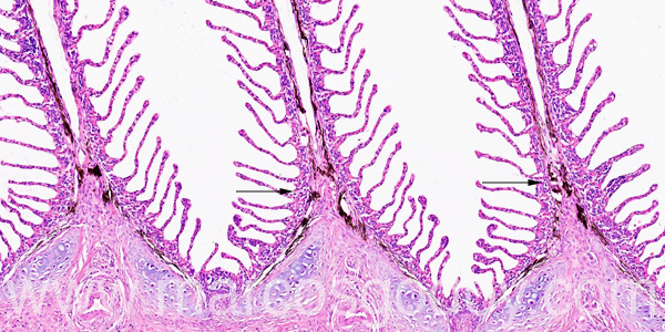 Gill melanomacrophages II
