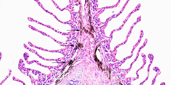 Gill melanomacrophages III