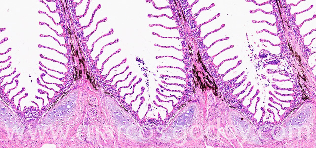 Gill melanomacrophages IV