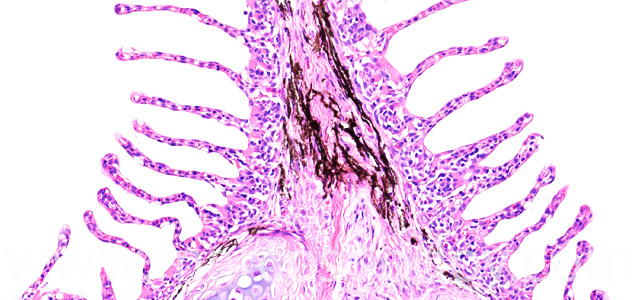 Gill melanomacrophages V