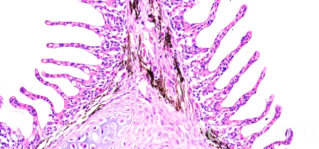 Gill melanomacrophages VII