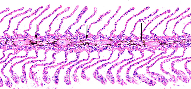 Gill melanomacrophages VIII