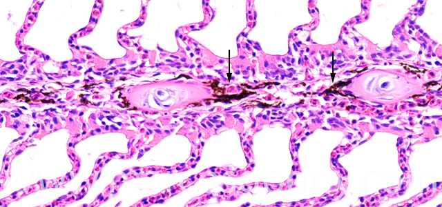 Gill melanomacrophages X
