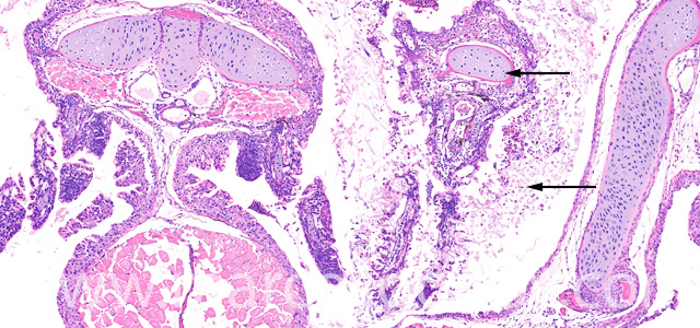 Saprolegnia gill necrosis V