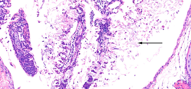 Saprolegnia gill necrosis VI