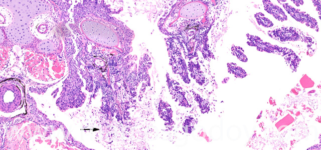 Saprolegnia gill necrosis X