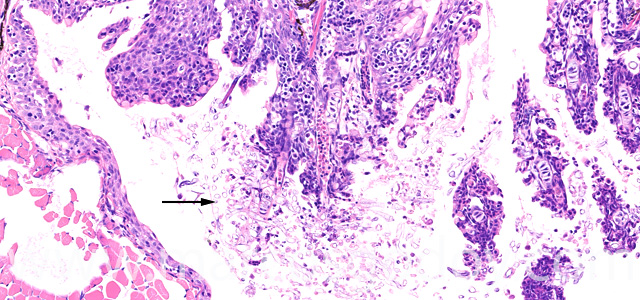 Saprolegnia gill necrosis XI