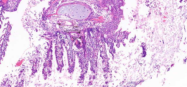 Saprolegnia gill necrosis XII
