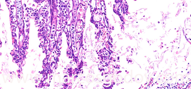 Saprolegnia gill necrosis XIII
