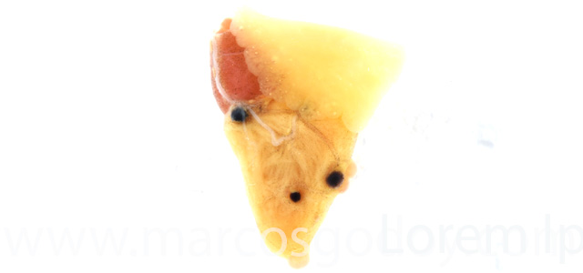 Aneurisma cardiaco VI