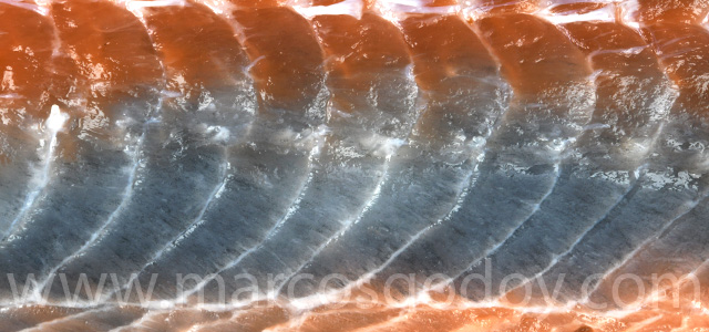 Diffuse melanosis 2023 XI
