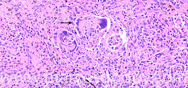 Giant cell II