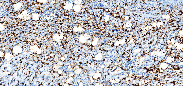 Dermatitis IHQ P. salmonis III