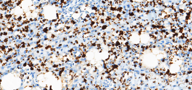 Dermatitis IHQ P. salmonis IV