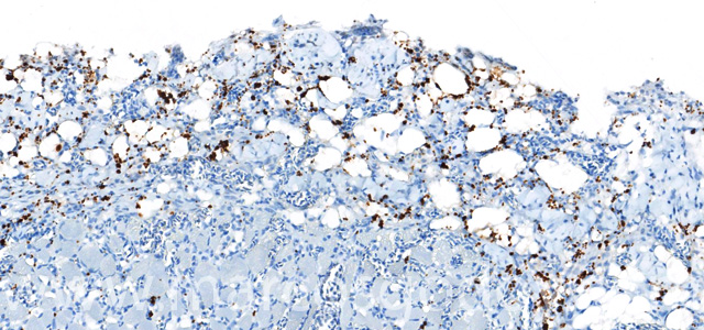 Dermatitis IHQ P. salmonis VI