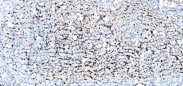 Dermatitis IHQ P. salmonis VII