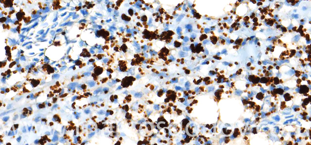 Dermatitis IHQ P. salmonis X