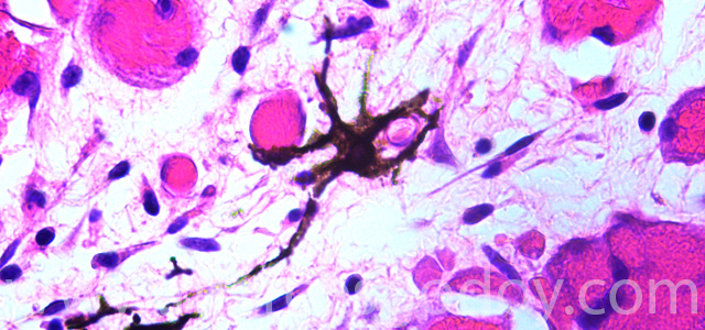 Malnomacrophages V