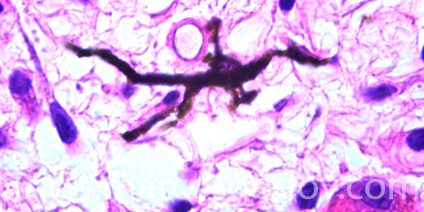 Malnomacrophages VIII