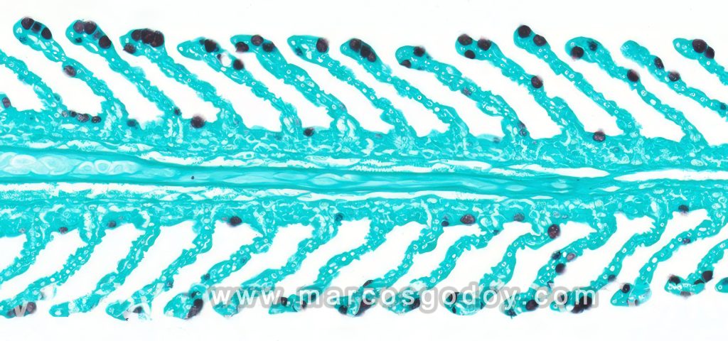 Hiperplasia de células mucosas branquiales en Salmón del Atlántico (Salmo salar): histopatología (tinción de Grocott)